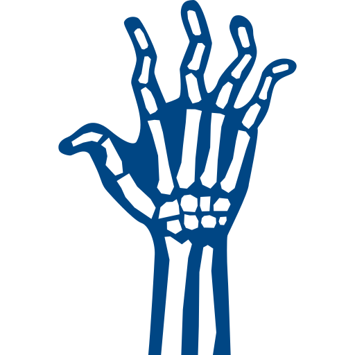 Rheumatoid Arthritis Treatment